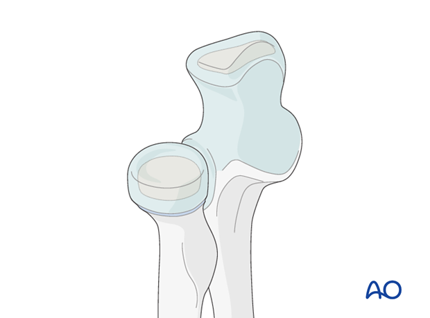 distal humeral surgical and developmental anatomy