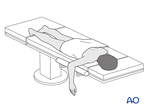 prone position