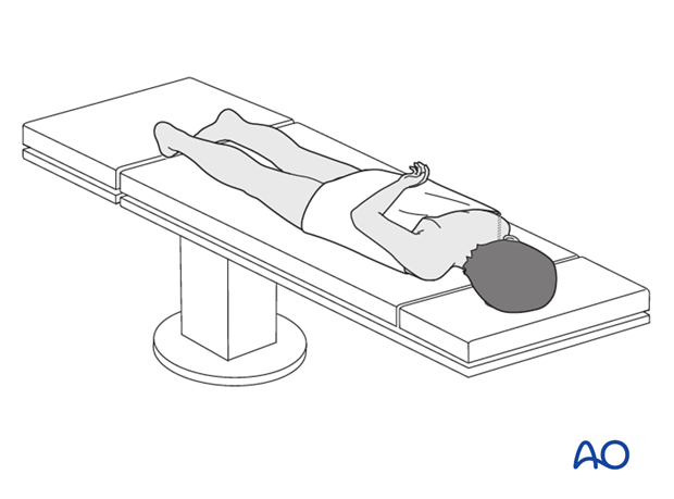 Prone for medial approach