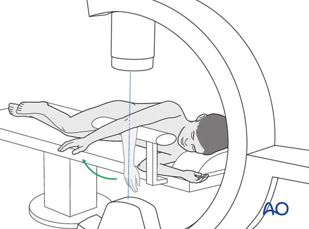 Lateral position - C-arm positioning