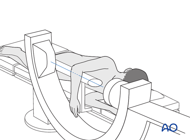 Lateral position - C-arm positioning