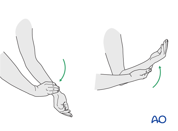 complications of radial head and neck fractures