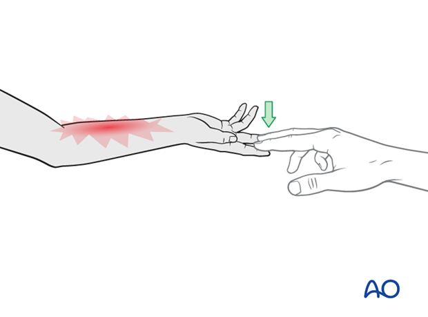 compartment syndrome