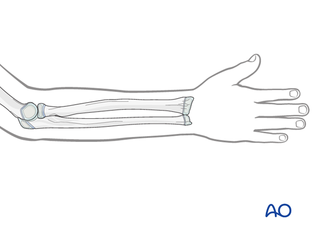 Forearm position