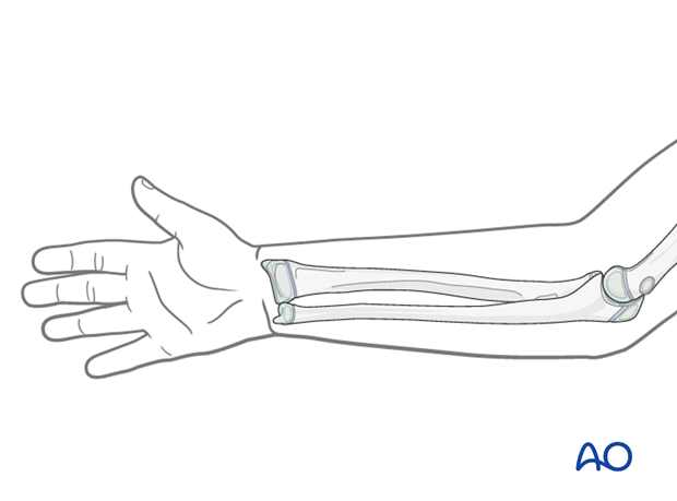 Forearm position