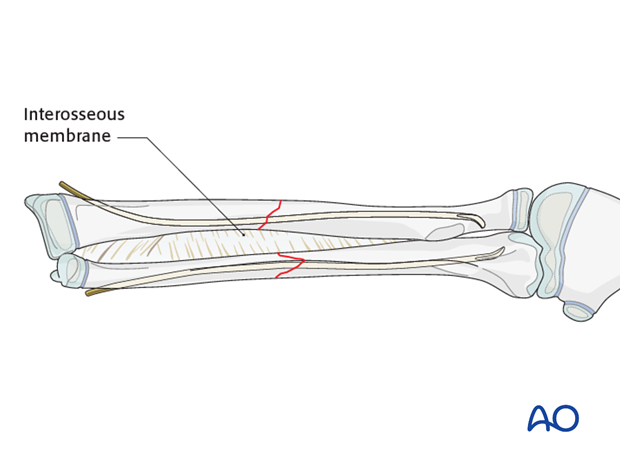 Final nail position