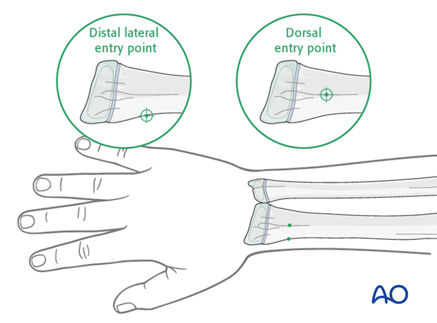 Entry points