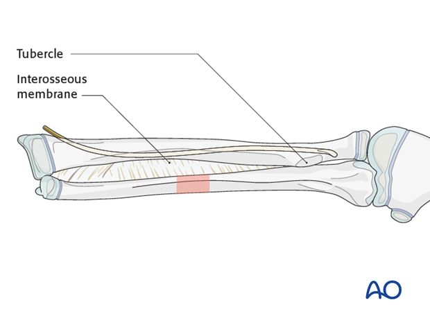 Final nail position