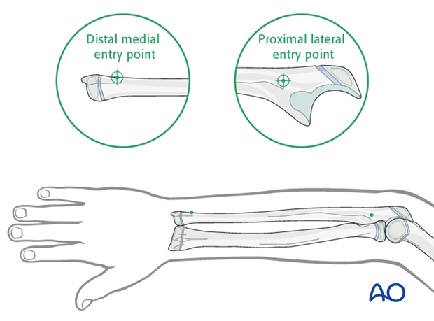 Entry points