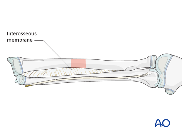 Final nail position