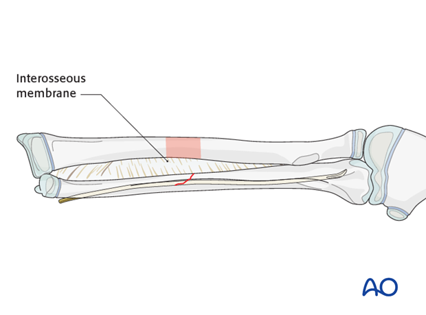 Final nail position