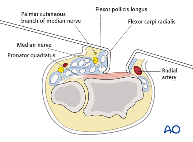 volar anterior approach to the distal radius