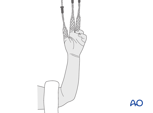 supine positioning