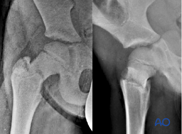 radiological assessment