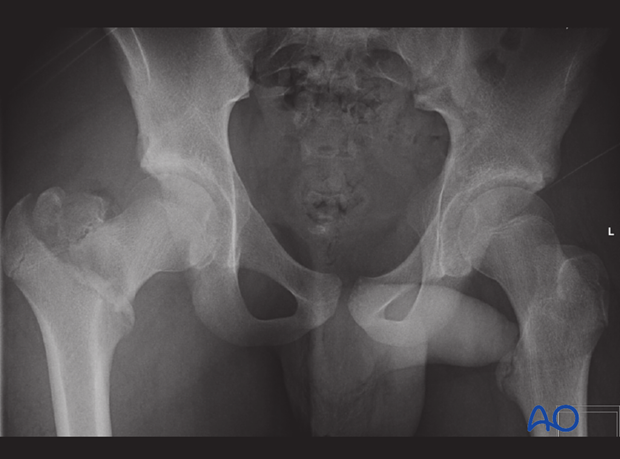 radiological assessment