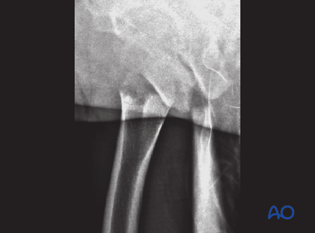 radiological assessment