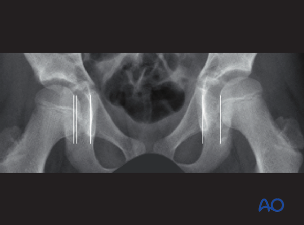 radiological assessment