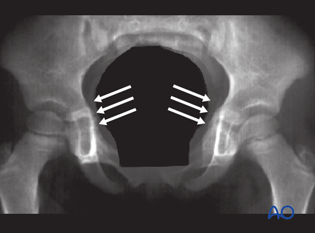 radiological assessment