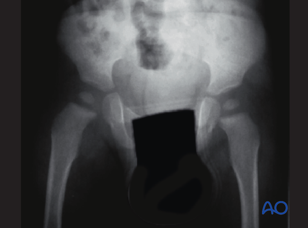 radiological assessment