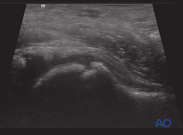 radiological assessment