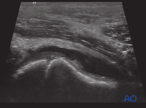 radiological assessment