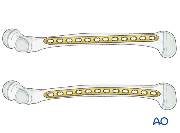 Straight and curved plate