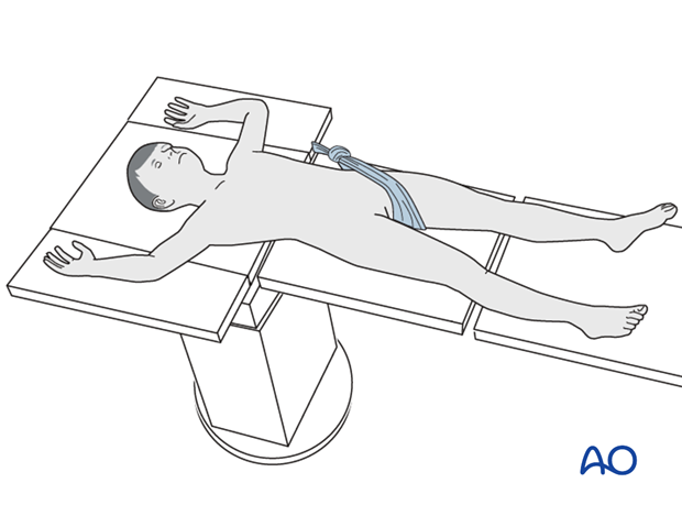 Pearl: Countertraction with sheet around pelvis