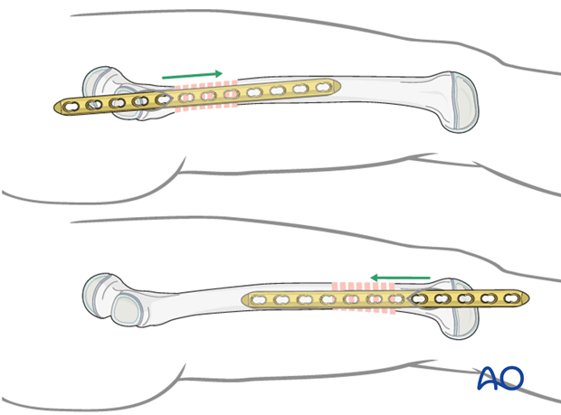 Direction of plate insertion