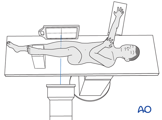 Patient position for lateral view x-rays