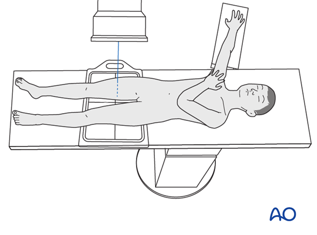 Patient position for AP view x-rays