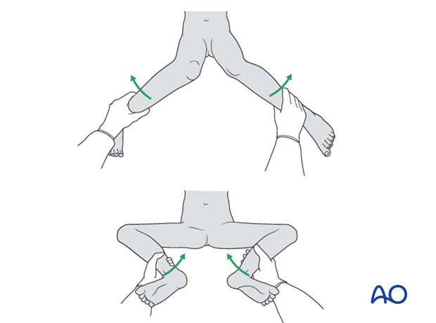 Postoperative examination of internal and external rotation