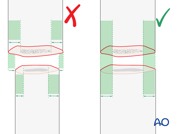 assessment of rotation