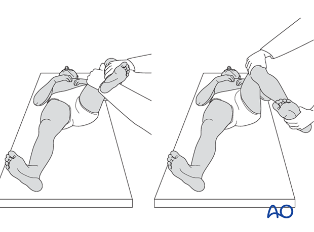 Clinical assessment of rotation of the uninjured leg