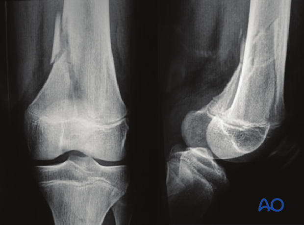 Radiological evaluation