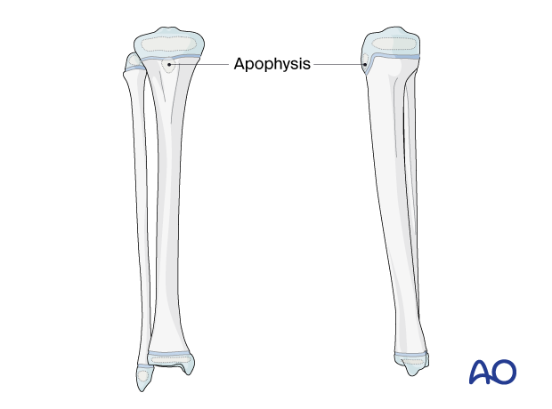 Pediatric tibia and fibula with proximal and distal physes