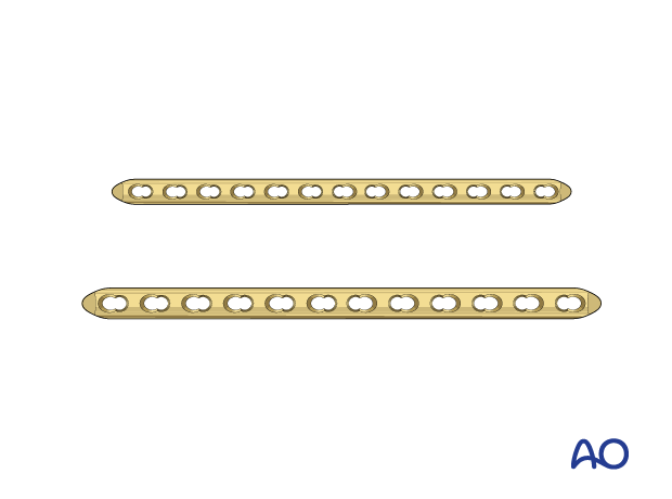 Open Reduction - Plate Fixation For Simple Transverse Tibial Fracture