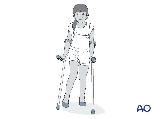 Pediatric patient with partial weight bearing and crutches