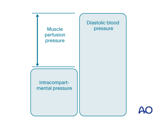 The muscle perfusion pressure (MPP) is the difference between diastolic blood pressure (dBP) and intracompartmental pressure.