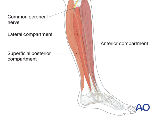 Lateral view of the pediatric lower leg showing the muscle compartments