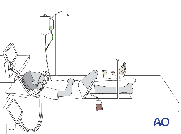 Unconscious pediatric patient with raised leg 