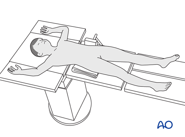 Supine position of a pediatric patient