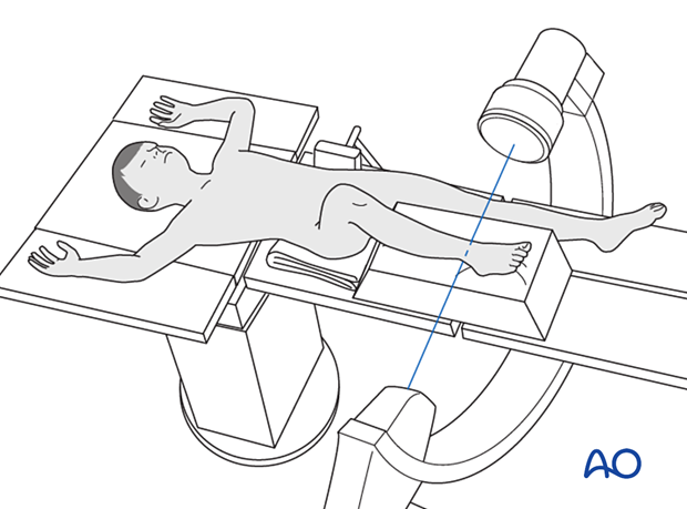 Supine position of a pediatric patient