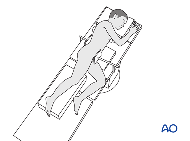 Lateral decubitus position of a pediatric patient