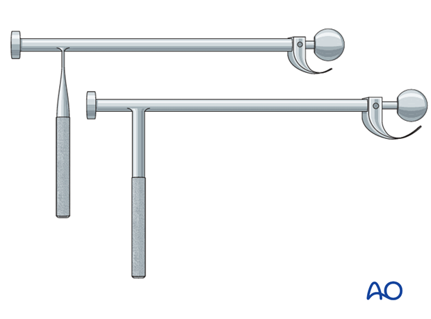 Acetabular osteotome system for cup removal