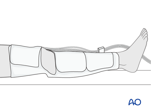 Pneumatic compression device