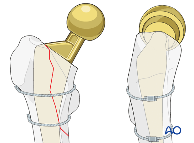 Crimp position