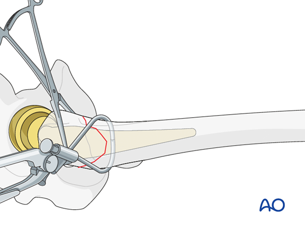 Handle components aligned