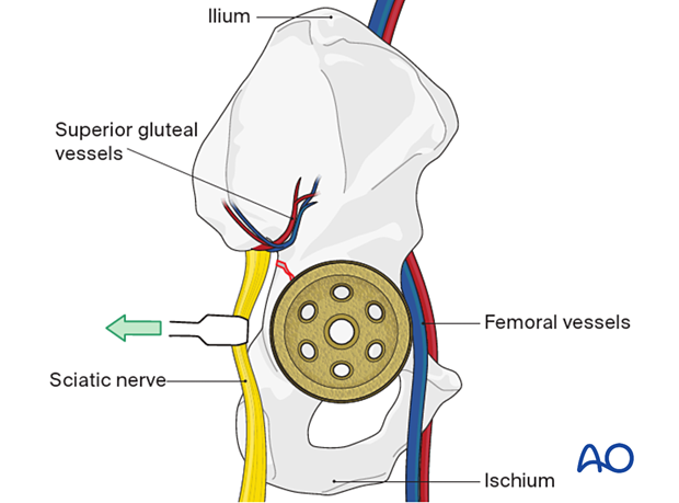 Acetabular neurovascular structures