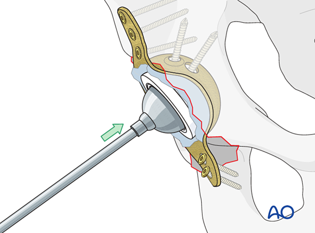 Liner insertion