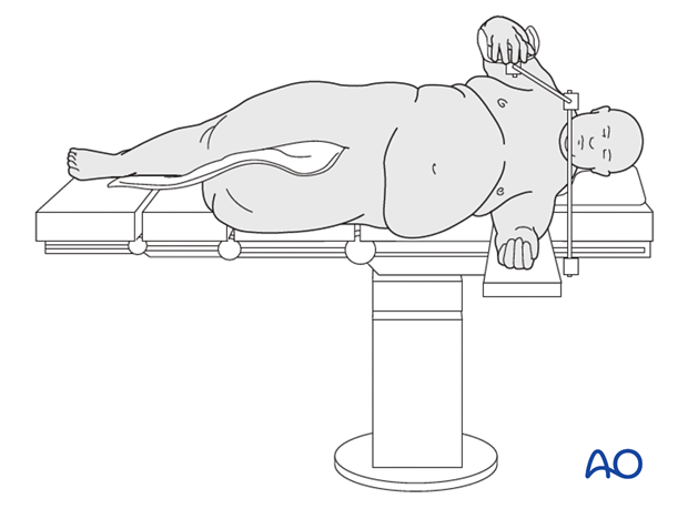 Pr130 Lateral position